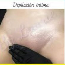 Depilaci&oacute;n  intima